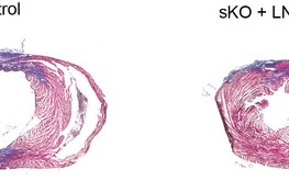 Cardiac regeneration becomes possible through reprogramming of