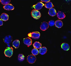 Leukocytes on migration. Immunohistochemical staining of migrating CD4 T cells (red: actin cytoskeleton; green: active RhoA; blue: nucleus).